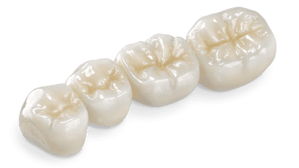 Bruxzir Crowns and Bridges